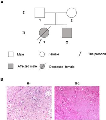 A Novel Germline Compound Heterozygous Mutation of BRCA2 Gene Associated With Familial Peripheral Neuroblastic Tumors in Two Siblings